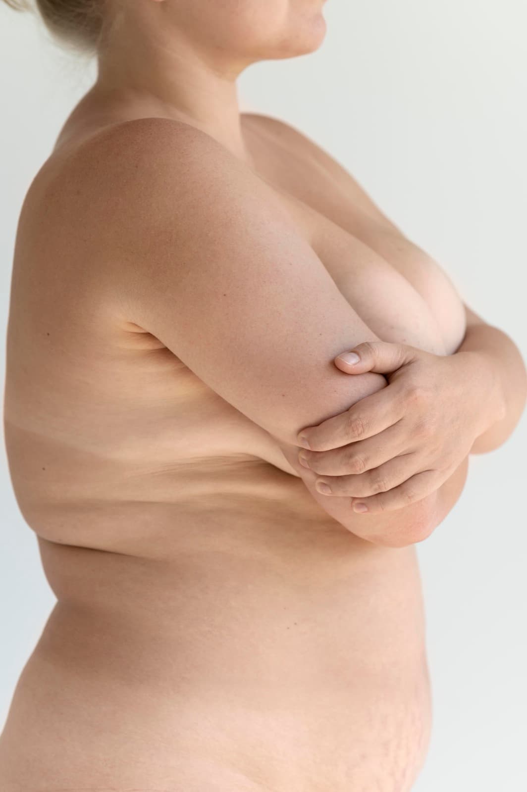Mastopexia e Mamoplastia Redutora